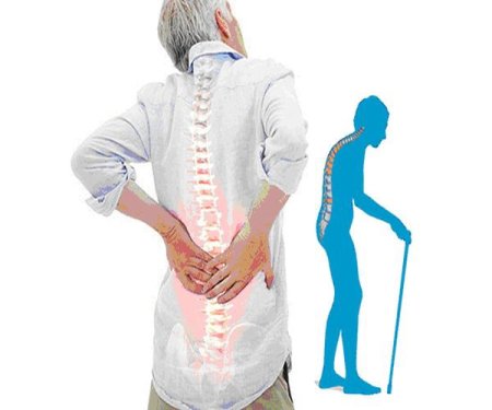 Защитная одежда при остеопорозе