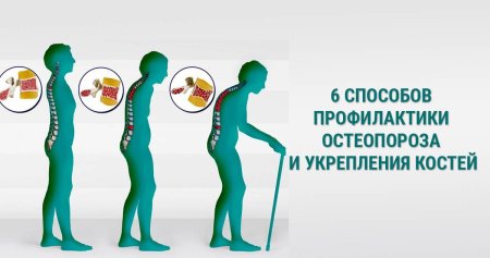 Профилактика остеопороза рисунок