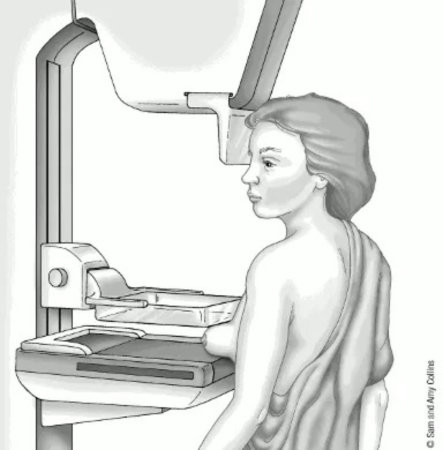 Маммография процесс