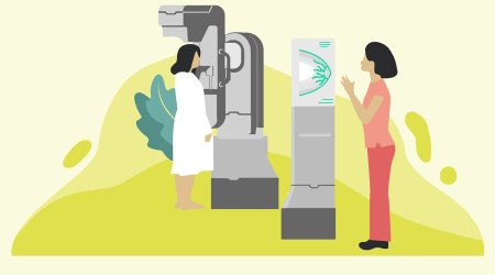 Маммография рисунок