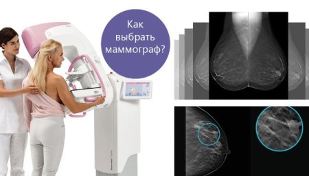 Цифровая маммография снимки