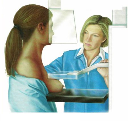 Mammograms рисунки