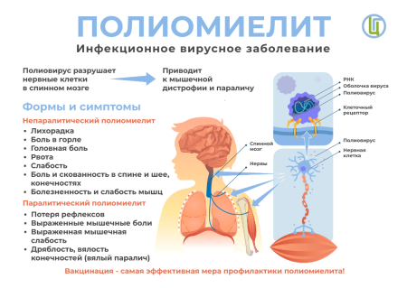 Полиомиелит карантин