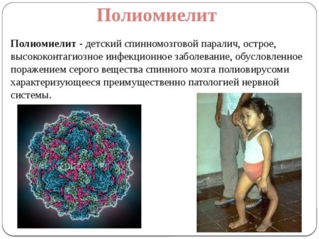 Специфическая профилактика полиомиелита