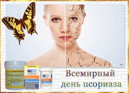 Всемирный день псориаза
