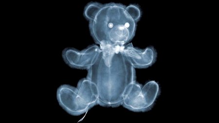 Поздравления с днём рентгенолора