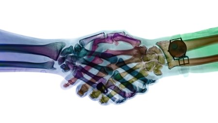 День рентгена