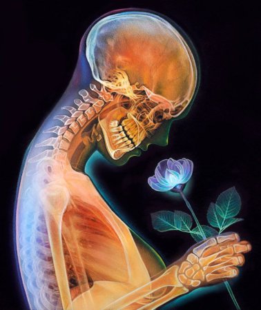 Рентгеновские снимки