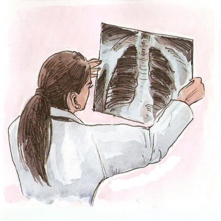 Туберкулез рисунок