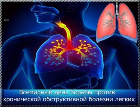 World chronic obstructive Pulmonary disease Day, World COPD Day