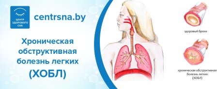 Всемирный день борьбы с хронической обструктивной болезнью легких