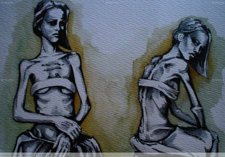 Дисморфоманическая анорексия