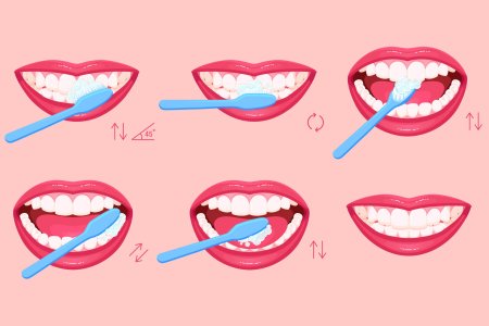 Векторная чистка зубов